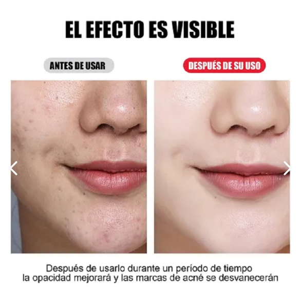 Máscara LED Facial 7 Colores – Rejuvenecimiento y Cuidado de la Piel